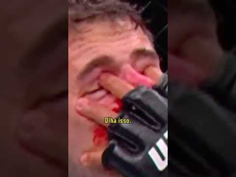 See the finger that caused the interruption of the fight between Tom Aspinall and Ciryl Gane #UFC...