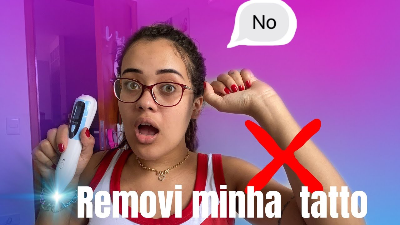 REMOVI A TATTO EM CASA ( CANETA JATO DE PLASMA)