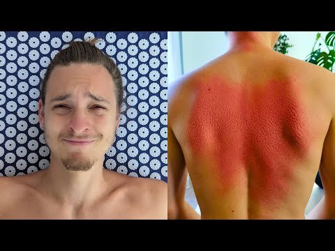 Diese Veränderungen habe ich nach 30 Tagen Akupressurmatte erfahren