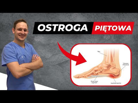 Ostroga Piętowa 3 Ćwiczenia Likwidujące Ból