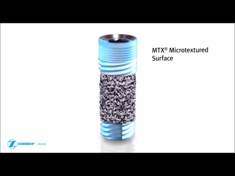 Zimmer Trabecular Metal Dental Implant