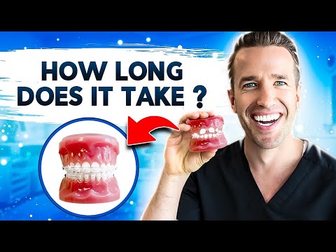 How Long Does It Take for Extraction Spaces to Close