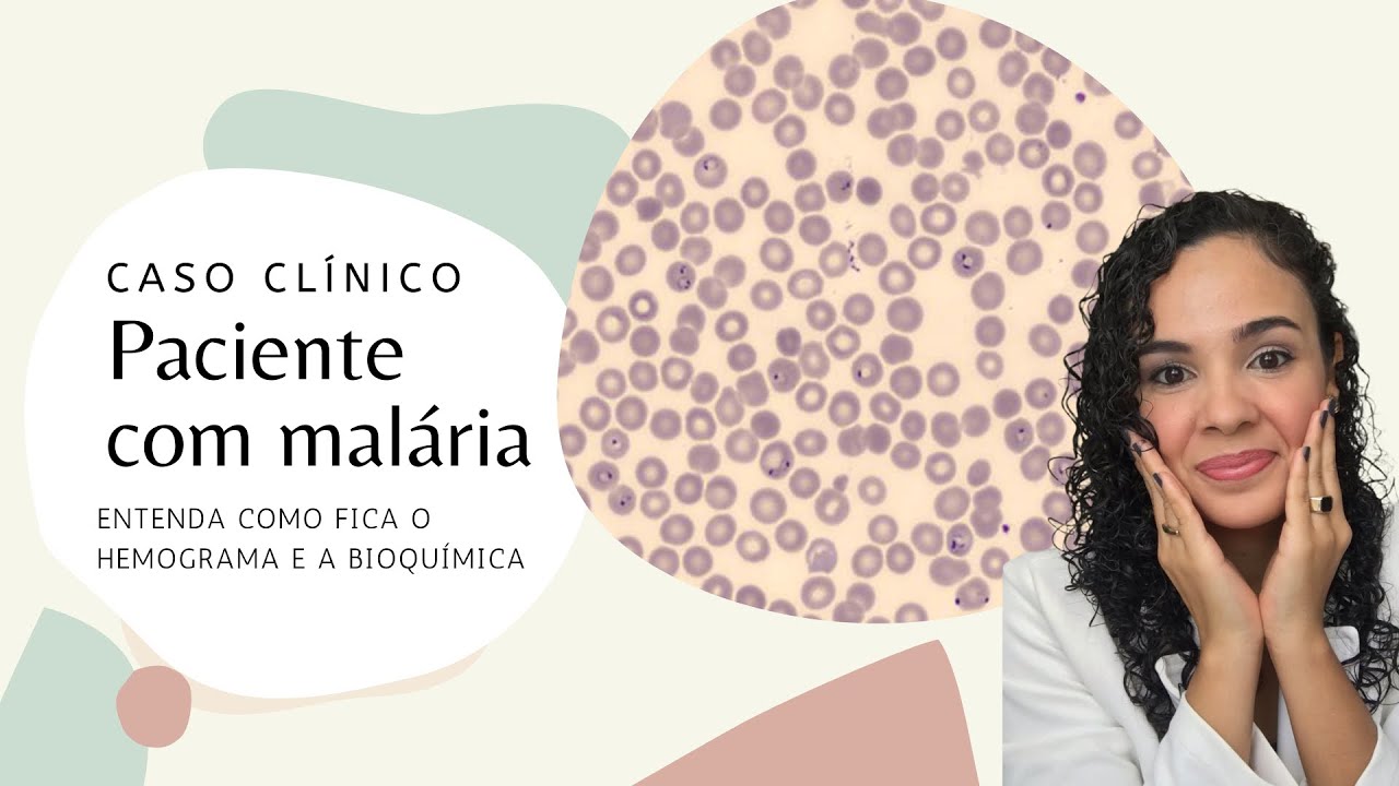 Caso clínico de paciente com MALÁRIA - hemograma e bioquímica
