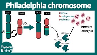 Philadelphia chromosome | Chromosome 9 to 22 translocation | BCR-ABL translocation| CML pathology