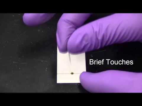 Thin Layer Chromatography