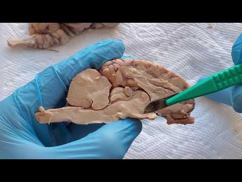 Sheep Brain 16 - Midsagittal View: Hypothalamus