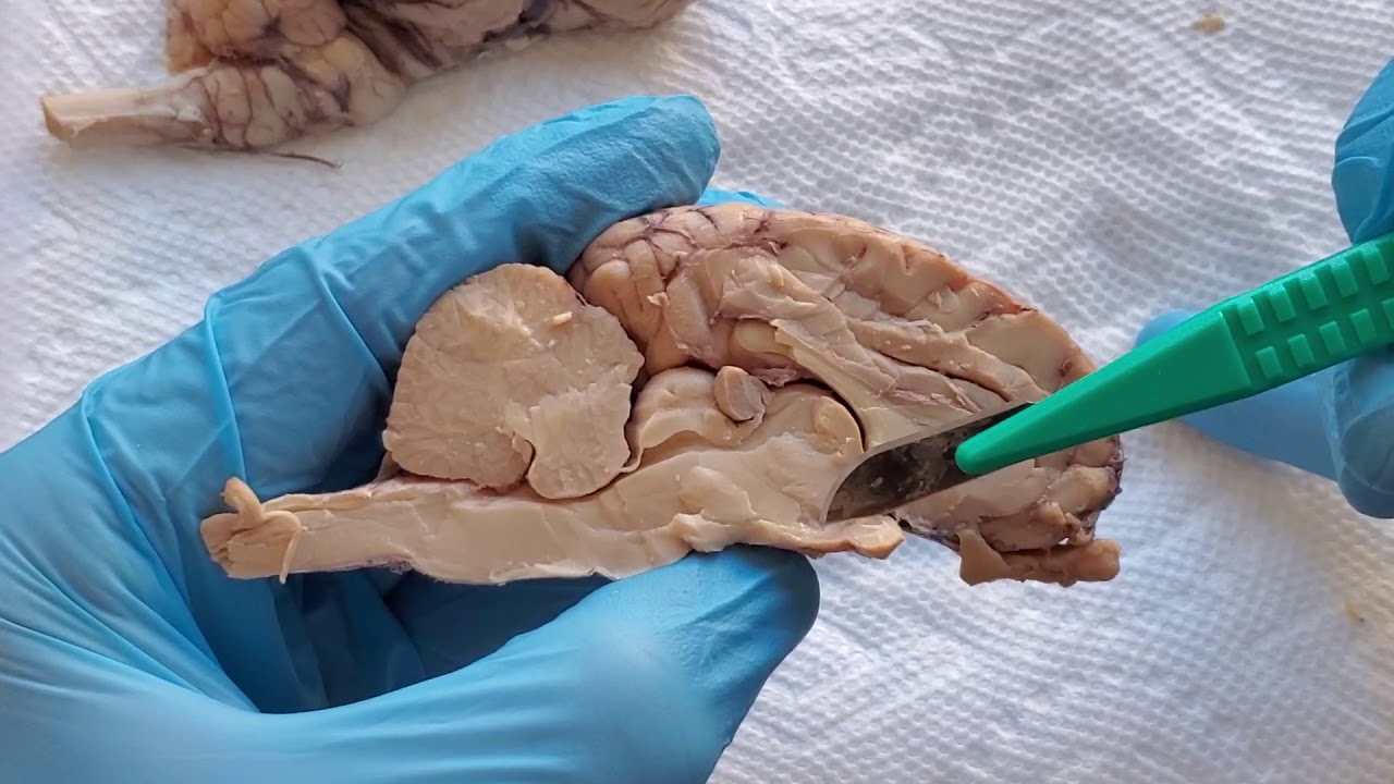 Sheep Brain 16 - Midsagittal View: Hypothalamus