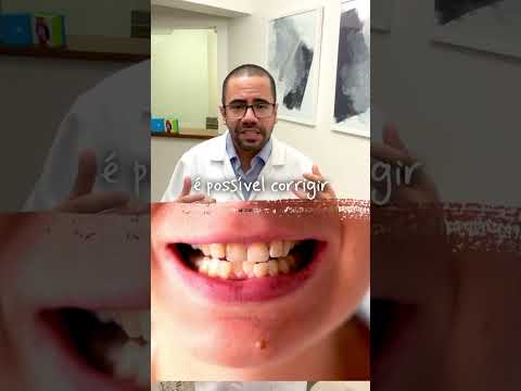 Éberson Luis Marques Sasso-10