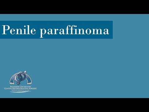 Penile Paraffinoma: Treatment, Cases