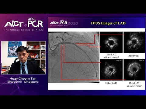 Optimise complex PCI outcomes through innovative technologies - AICT-AsiaPCR 2020