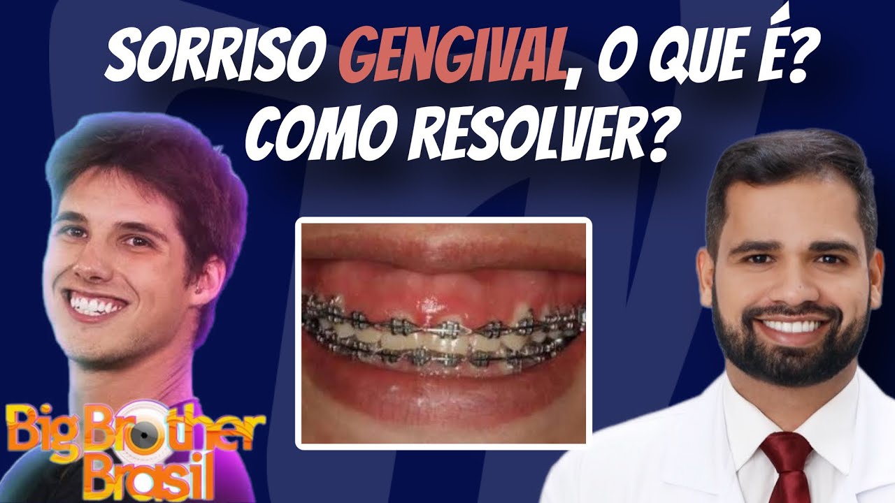 Francisco De Assis Almeida Lima Júnior-35