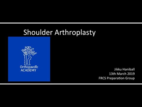 Shoulder Arthroplasty for Orthopaedic Exams