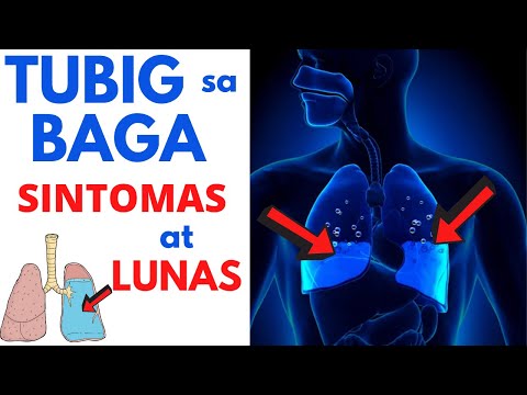 🫁 15 SINTOMAS ng TUBIG sa BAGA | Pneumonia ba o iba? Paano gamutin o operation? Mga SANHI at LUNAS
