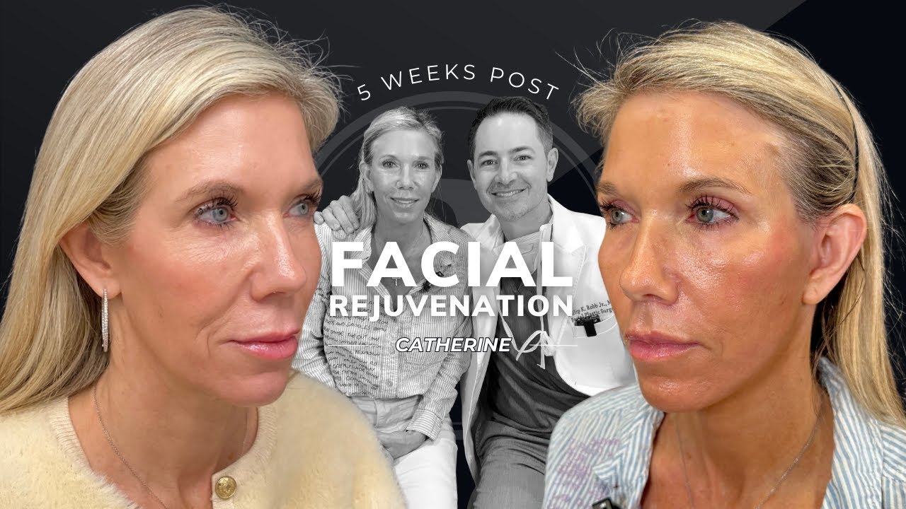 Robb Facial Plastic Surgery