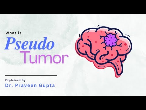 Guillain-Barré Syndrome (GBS) Recovery
