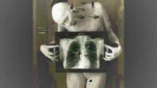 sopor aeternus - dead soul