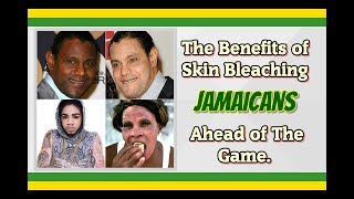 Reasons Why Jamaicans Bleach Their Skin