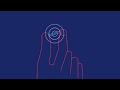 Effectiveness Of The Birth Control Implant In Your Arm Planned Parenthood Video