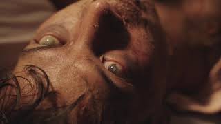 The Itch | Trailer | 2024