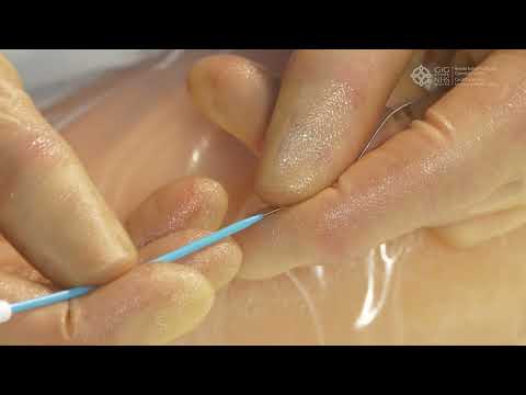 Vygon Smart Midline Insertion