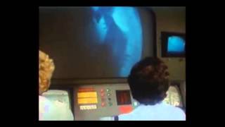 SHAKE THE DISEASE - Unknown