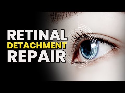 Get Rid Of Eye Floaters Fast | Remove The Vitreous | Retinal Detachment Repair | Eye Health Music
