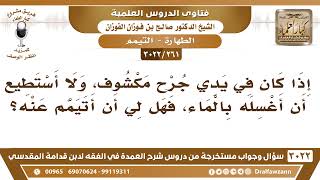 صورة [261 -3022] إذا كان في يدي جرحٌ مكشوف، ولا أستطيع أن أغسله بالماء، فهل لي أن أتيمم عنه؟