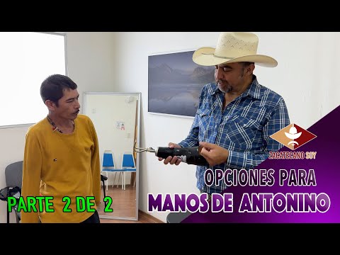 PRÓTESIS MECÁNICA la opción más viable para Antonino