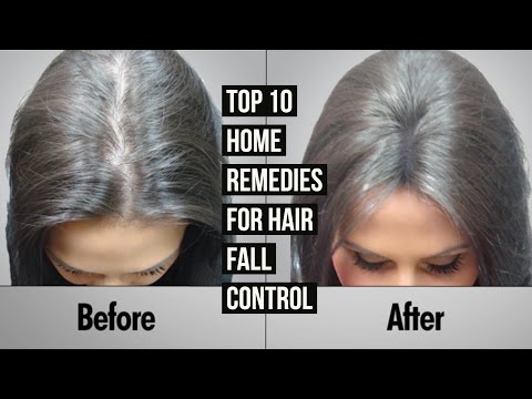 Top 10 Home Remedies For Hair Fall Control
