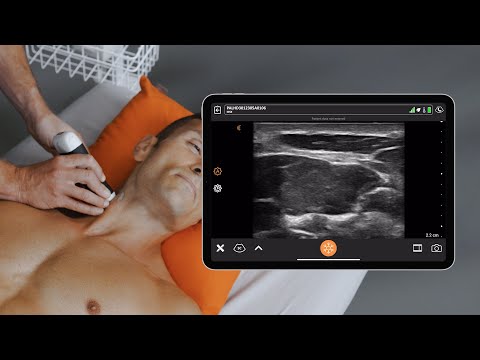 Superficial Cervical Plexus Block