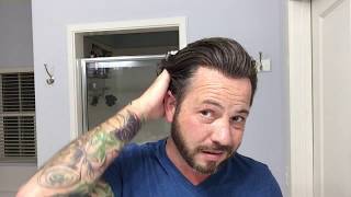 MOST frequently asked questions about Hair Replacement or a Hair System Take 3!!