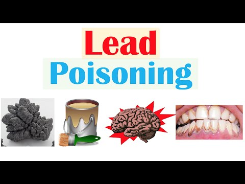 Lead Poisoning (Lead Toxicity) | Sources, Pathophysiology, Signs & Symptoms, Diagnosis, Treatment