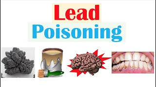 Lead Poisoning (Lead Toxicity) | Sources, Pathophysiology, Signs &amp; Symptoms, Diagnosis, Treatment
