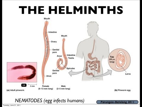 Az emberek helmintos invázió tünetei Felnőttkori helminták tünetei