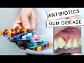 Can Antibiotics Cure Gum Disease?