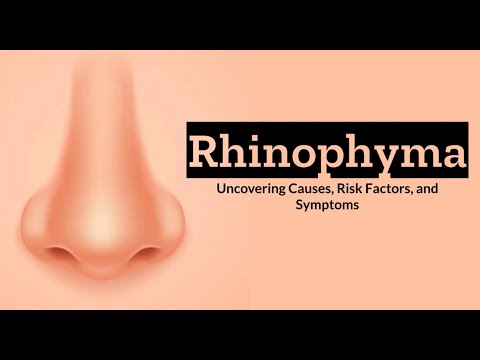 Effects of Cannabis on your body