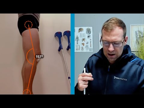 Streckdefizit nach Kreuzbandriss wegtrainieren - DAS musst du wissen