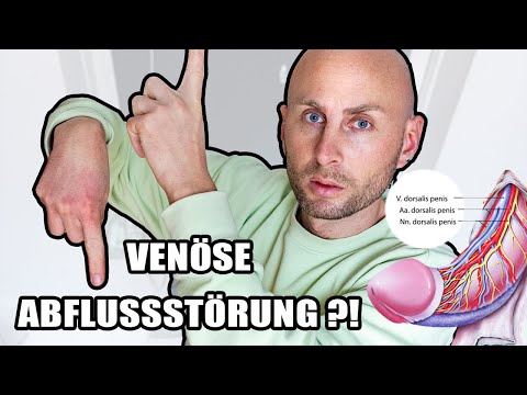 Venöse Abflussstörung Penis: Genital Erkrankung! Hard Flaccid, Balanitis, Harnröhrenentzündung, Ödem