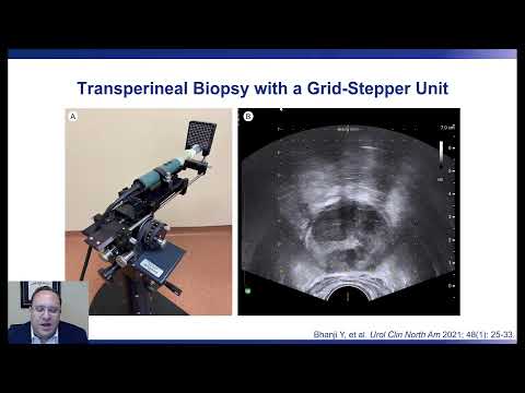 Transperineal Prostate Biopsy: A New Standard of Care?