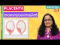 Low Lying Placenta | Placenta Previa | placenta താഴയേയാണെങ്കിൽ എന്തൊക്കെ 
