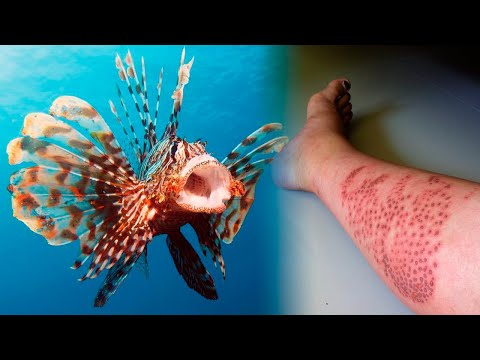 The MOST VENOMOUS ANIMALS Of The Ocean