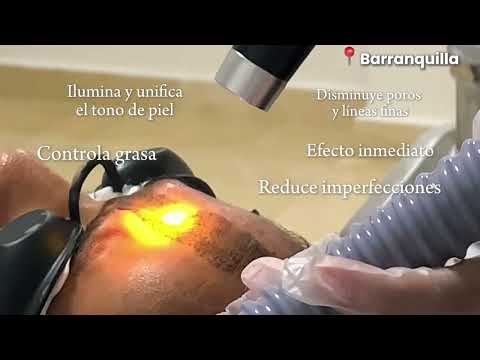 video 49YW3sm1_pY