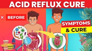 I wish I knew this earlier! How to treat acid reflux, Heartburn and GERD