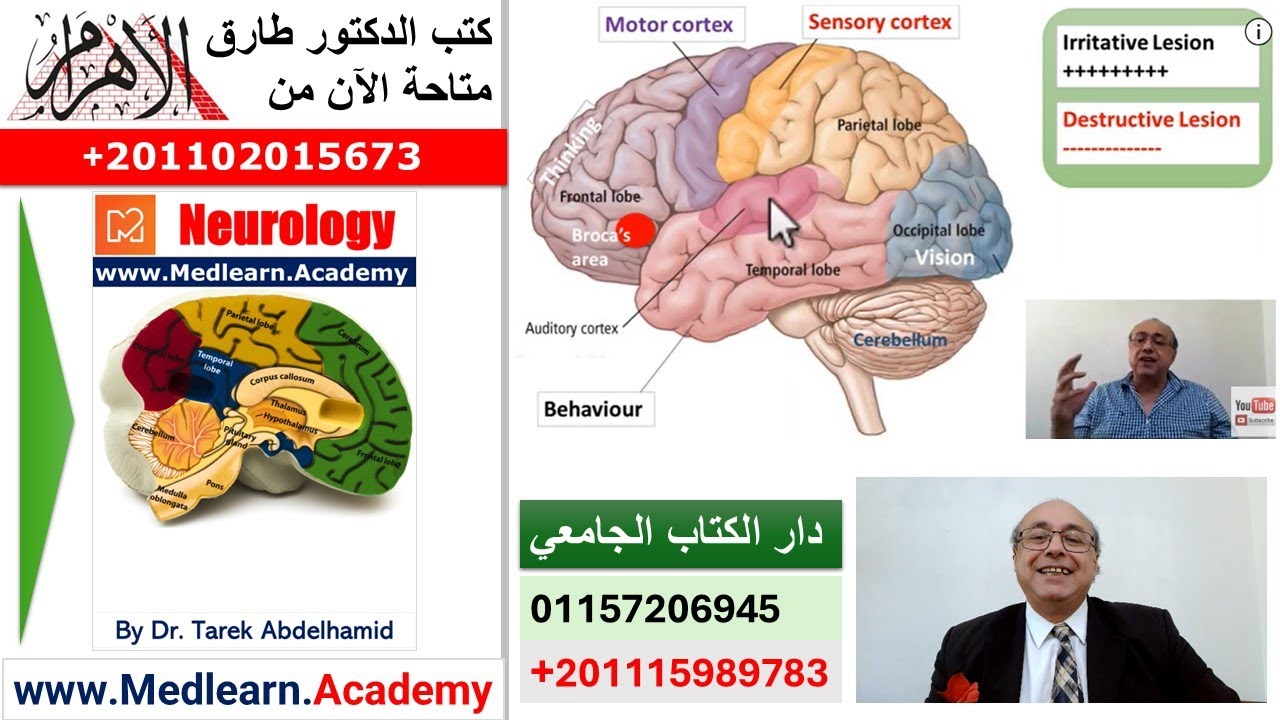 Localization of Neurological Lesions (Part 5)