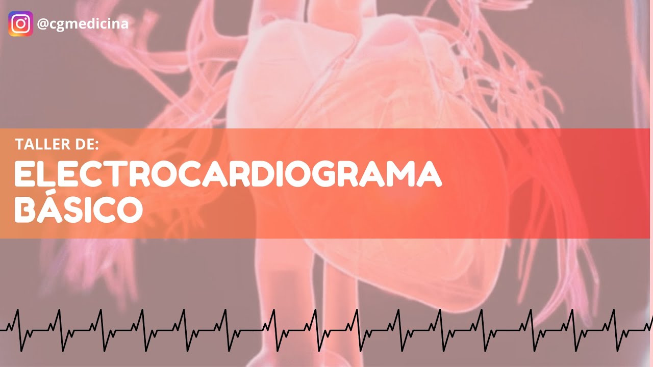 Taller de EKG II: Arritmias, Infarto y otros