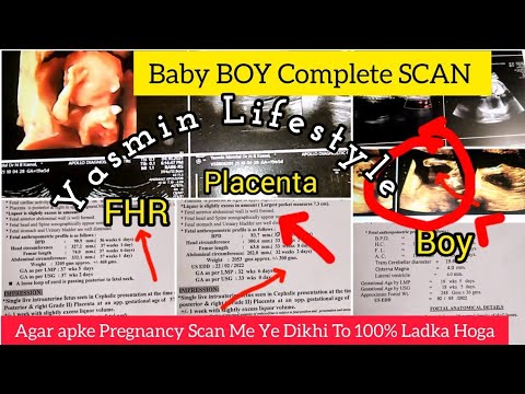 My Complete PREGNANCY Scan ll Baby BOY Scan ll Baby Boy Symptoms #anomalyscan