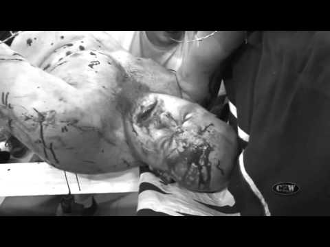 Bleeding Black & Yellow: The Ultraviolent Dream [Official Trailer]