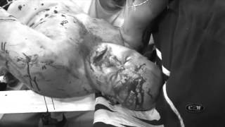 Bleeding Black & Yellow: The Ultraviolent Dream [Official Trailer]