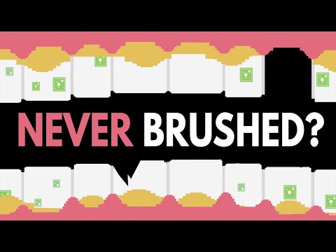 What Would Happen If You Never Brushed Your Teeth?