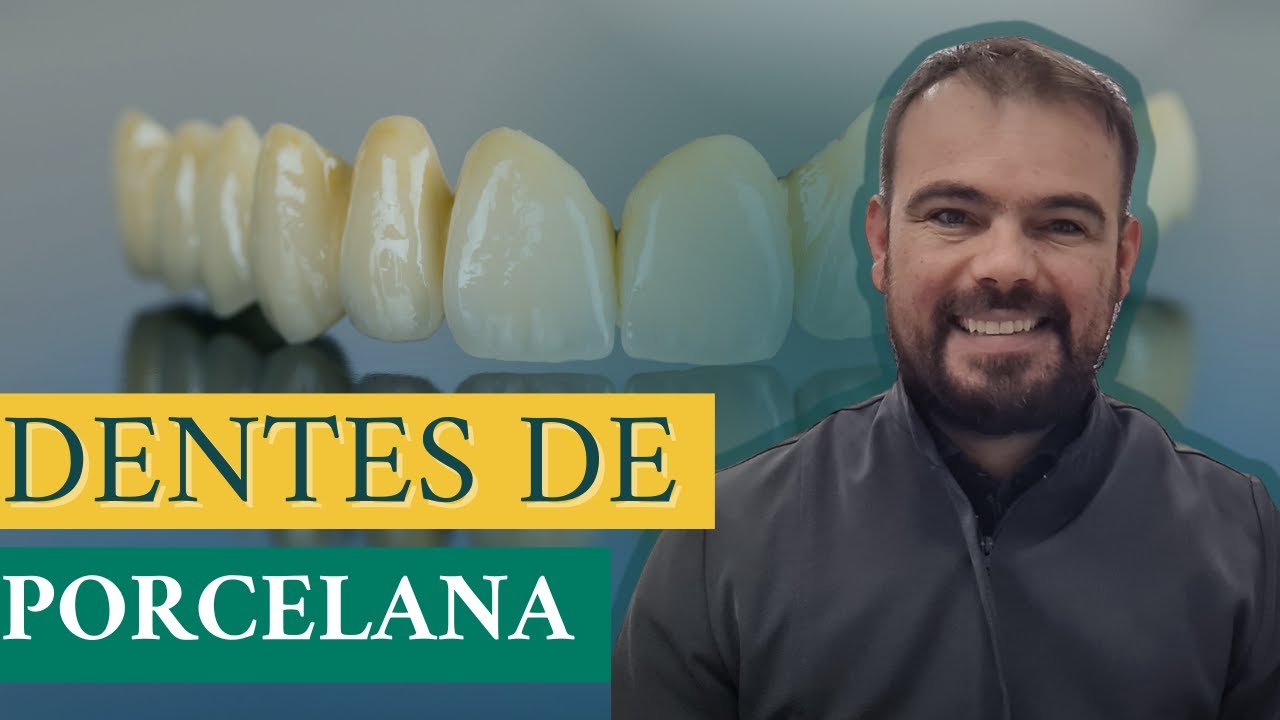 FACETAS , LENTES OU COROAS DE PORCELANA